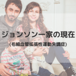 ジョンソン一家(AT)の現在と子供は？｜毛細血管拡張性運動失調症